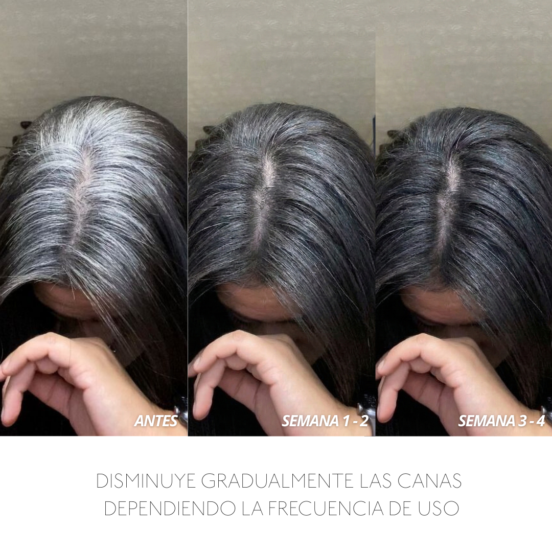 Resultados de tratamiento capilar: reducción gradual de canas en 4 semanas - Luxent Professional